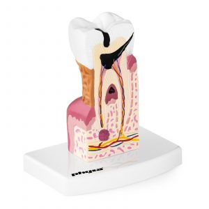 Model nemocného zubu 10040250